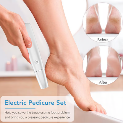 🔥Vente rapide - 50 % de réduction🔥  Extracteur de callosités électrique pour les pieds