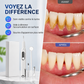 🦷 PROMO FLASH : 50% DE RÉDUCTION ! Détartreur Ultrasonique Électrique – 5 Modes Réglables, Moteur 500W & Têtes Interchangeables à 21° for un Nettoyage Dentaire Professionnel à Domicile ✨💎